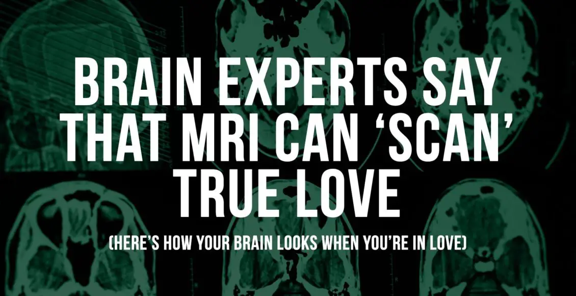 Brain Experts Say That an MRI Can 'Scan' True Love