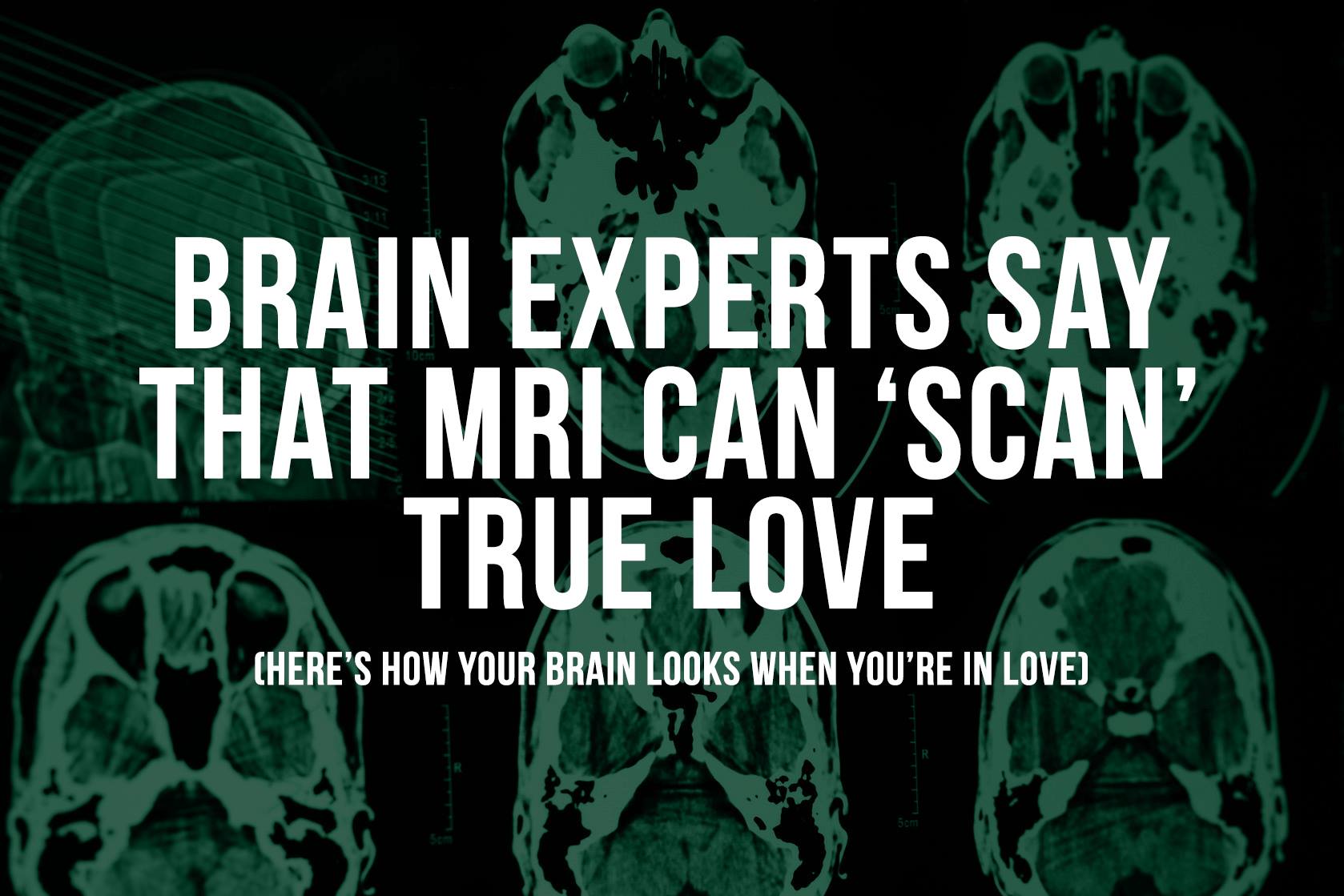 Brain Experts Say That an MRI Can 'Scan' True Love