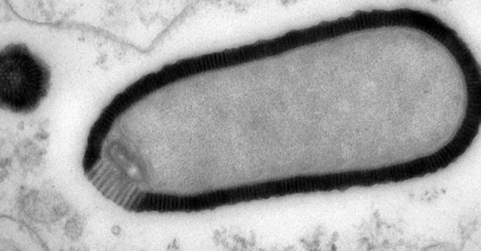 Awaken 30,000-Year-Old "Giant Virus"