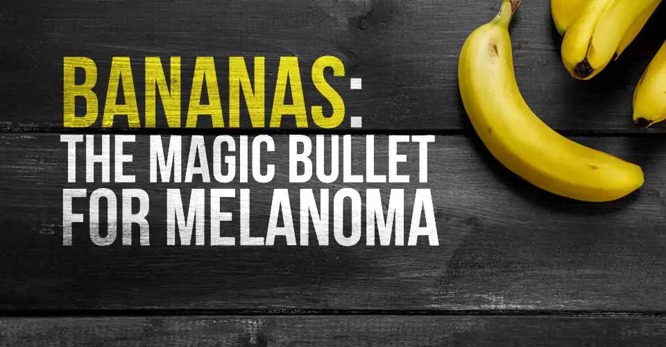 Bananas: The Magic Bullet for Melanoma