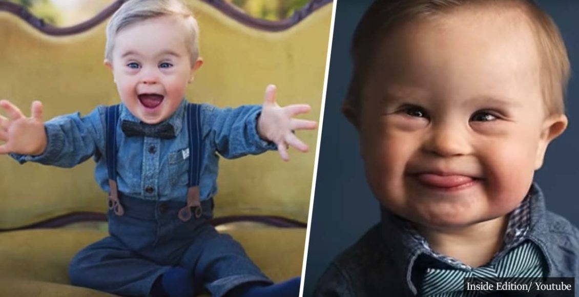 16-Month-Old Toddler With Down Syndrome Becomes Model