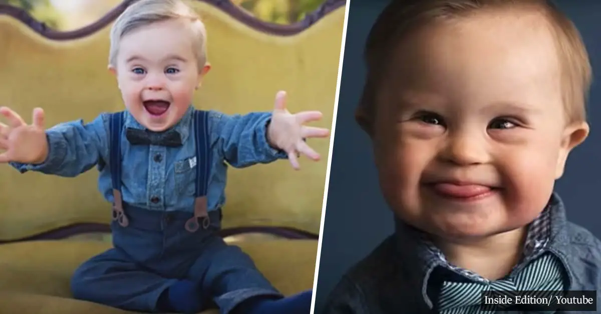 16-Month-Old Toddler With Down Syndrome Becomes Model