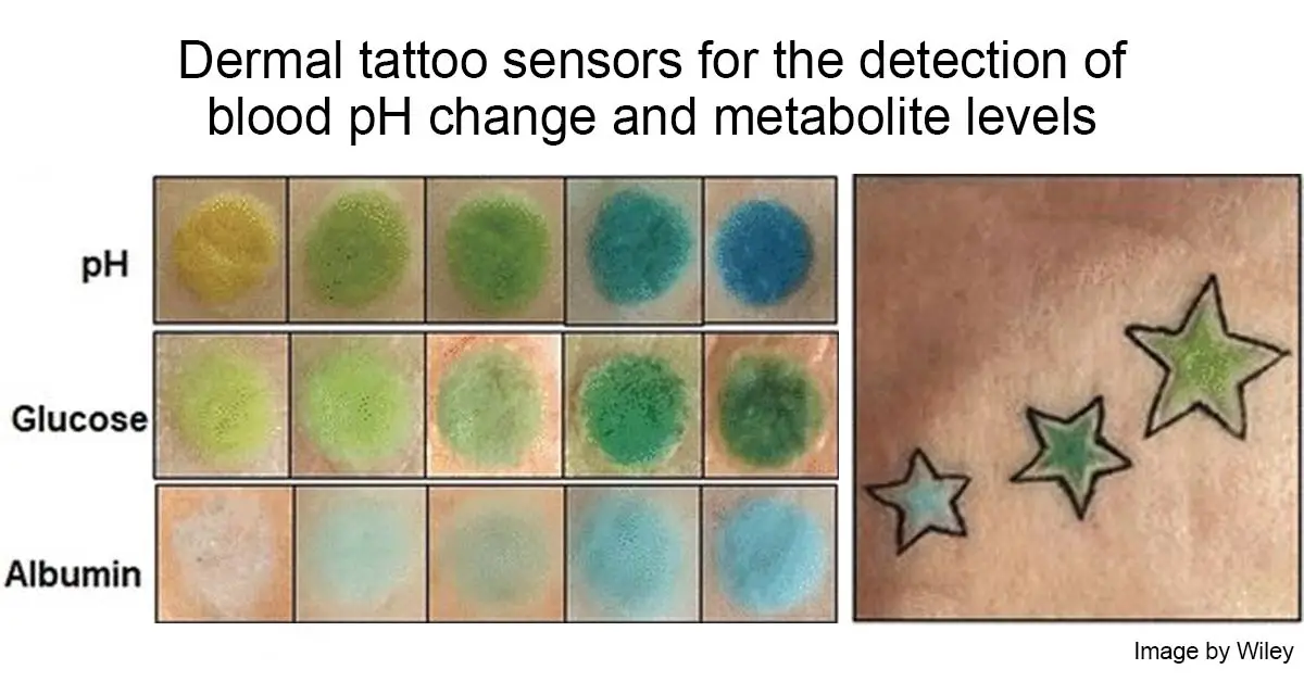 Sensing with your skin - new dermal tattoo sensor technology to detect changes in blood pH and metabolite levels