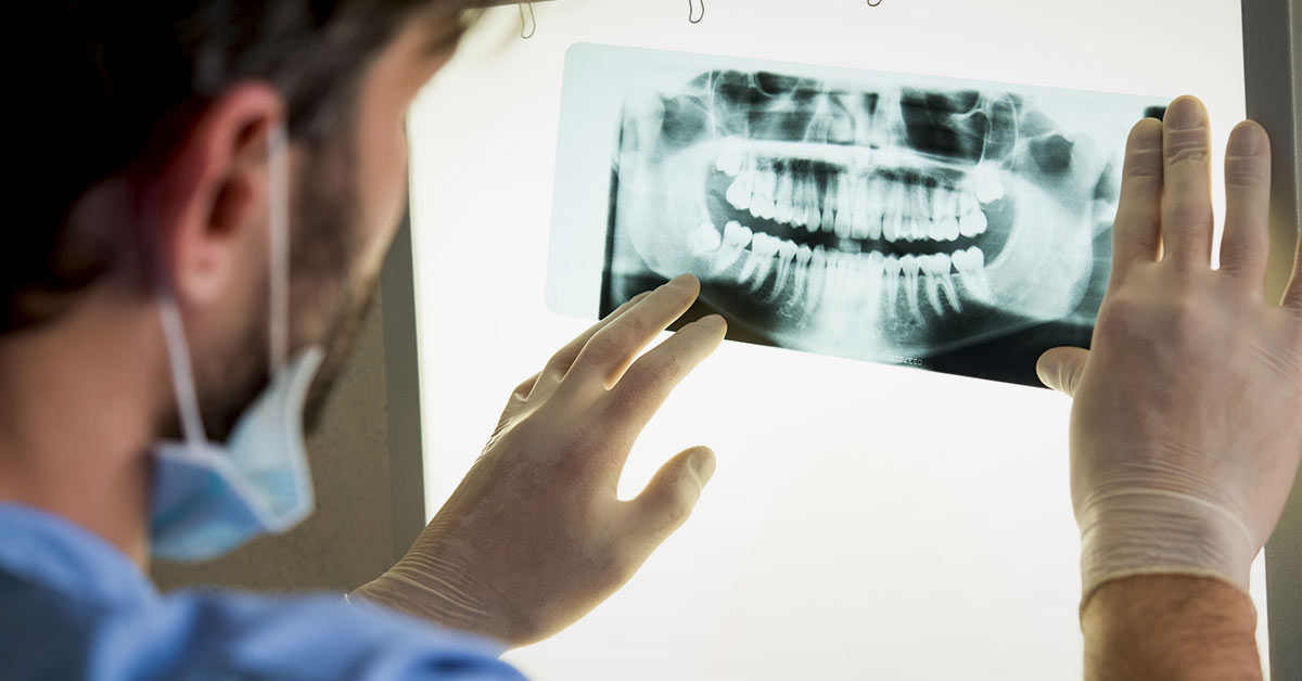 Breakthrough discovery may allow dentists to regenerate the roots of teeth