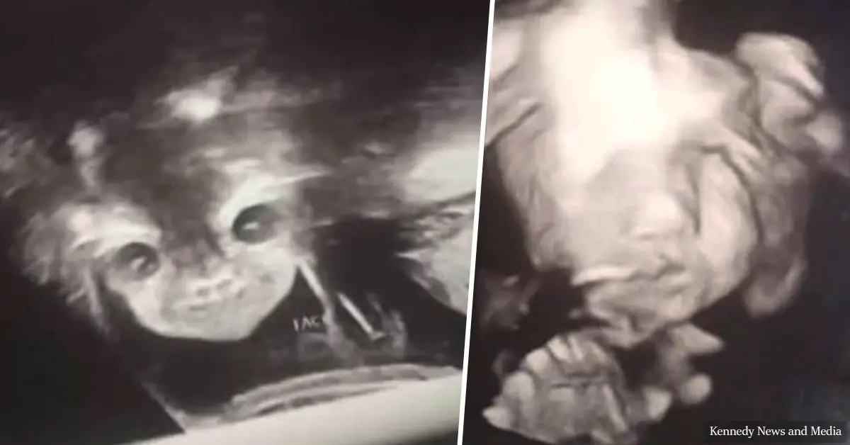 Shocking pregnancy scan of staring 'devil baby' scares a young mom to be