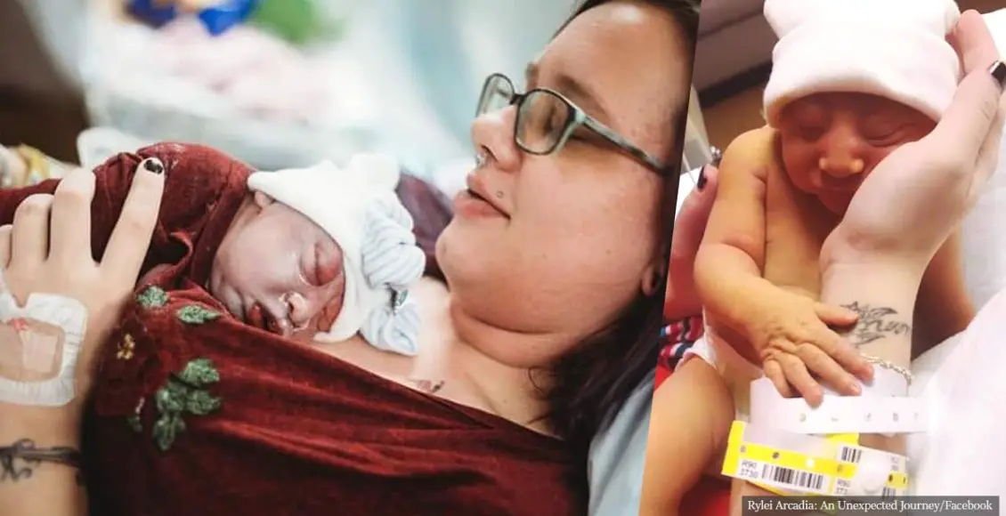 Selfless mom gives birth to dying baby girl so she could donate her organs and save lives