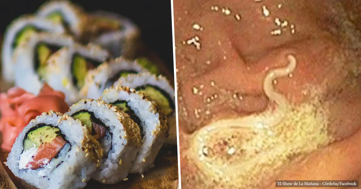 Sushi warning: doctors find worms in man's gut