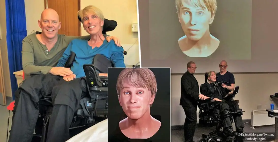'I'm not dying, I'm transforming': Doctor diagnosed with lethal motor neuron disease aspires to become the world's first true cyborg