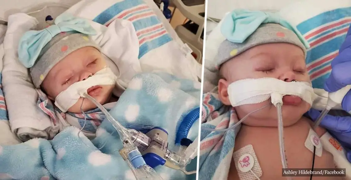 Mother Releases Socking Photo Of Quarantined 2-month-Old In Hospital After Contracting Coronavirus