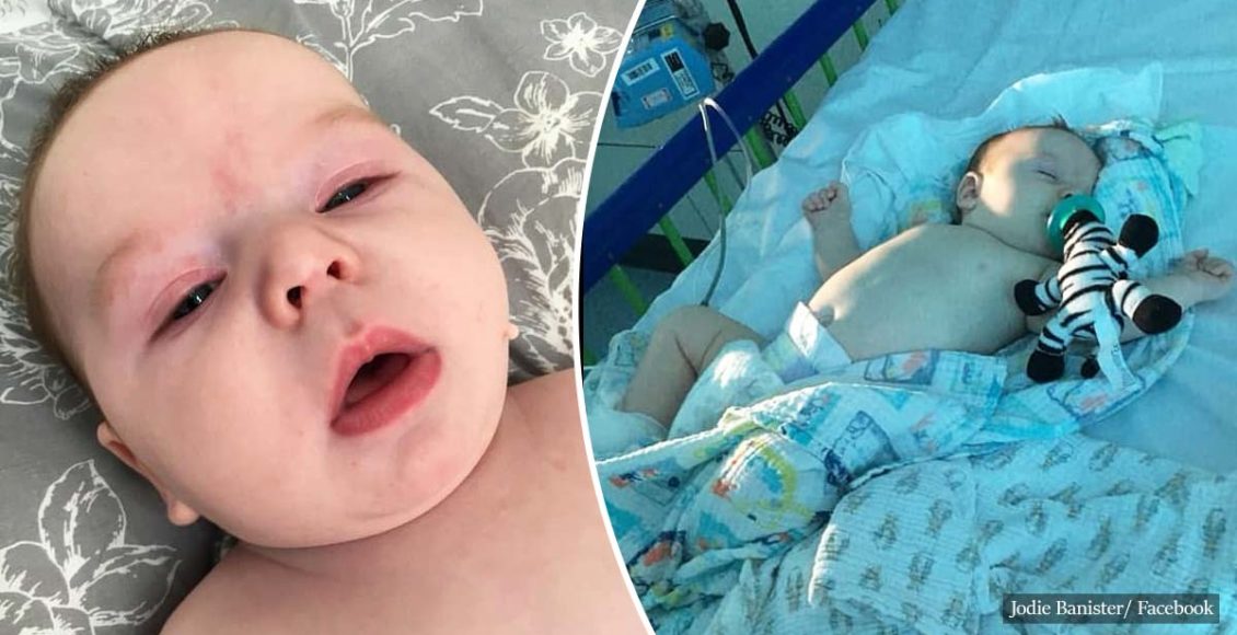Baby Boy, 11 Weeks-Old, Hospitalized With COVID-19
