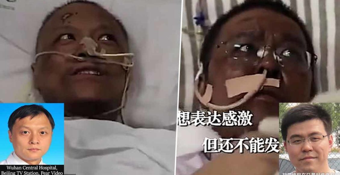 Chinese Doctors Critically ill With COVID-19 Wake Up With Darkened Skin