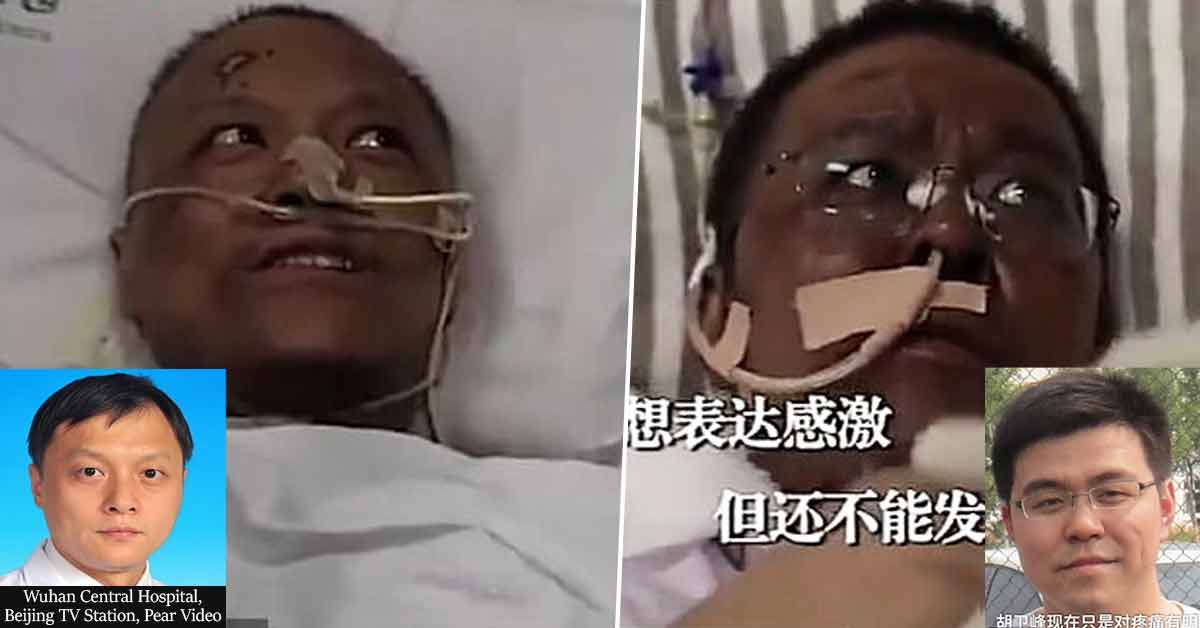 Chinese Doctors Critically ill With COVID-19 Wake Up With Darkened Skin