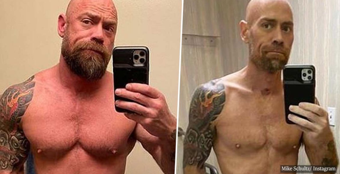 Man Shares Before-And-After Photo Of Body After COVID-19