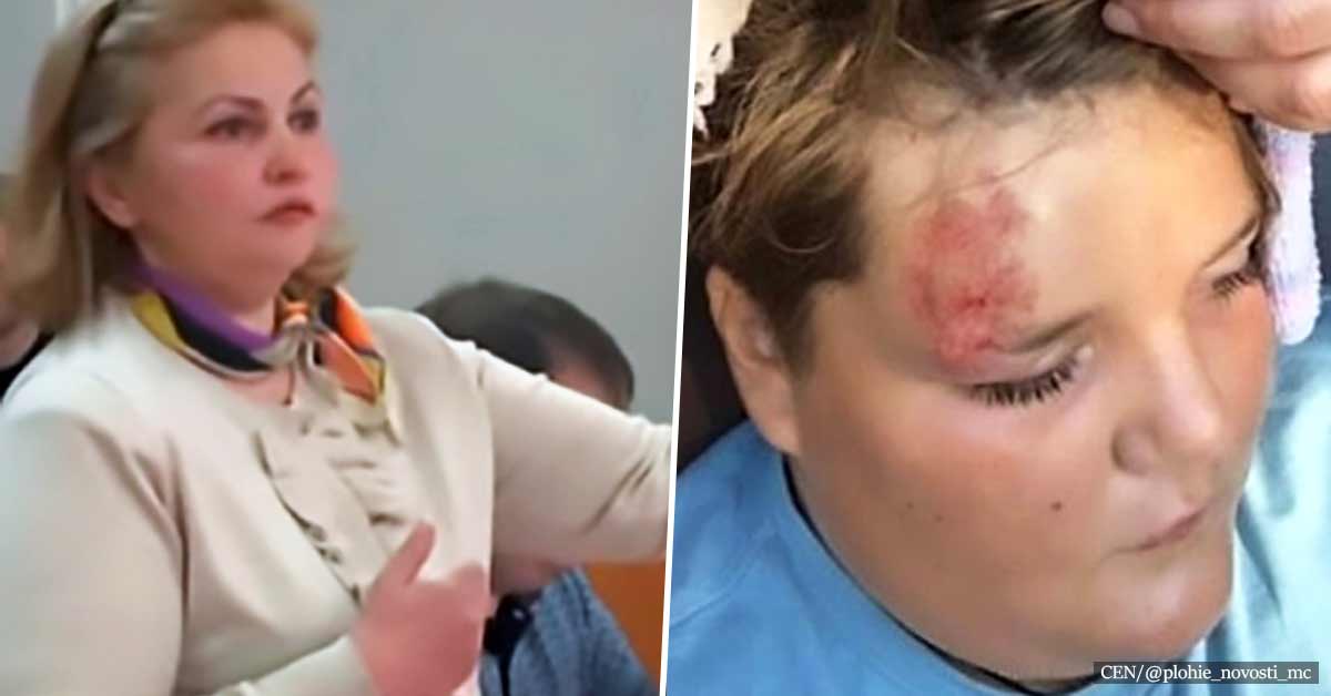 Russian woman sues a 12-year-old on bike for scratching the car she hit him with