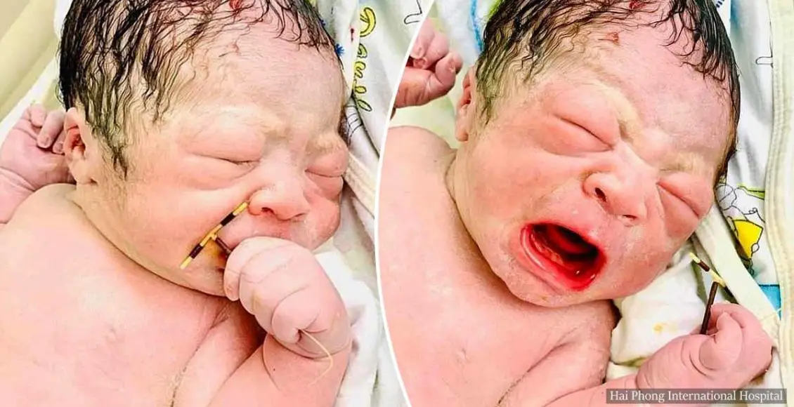 Newborn baby boy captured on camera holding his mother's failed contraceptive coil, moments after his birth.