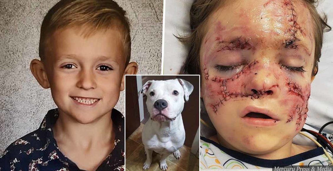 Boy, 6, suffers horrific injuries after mauled by 'loveable' family dog