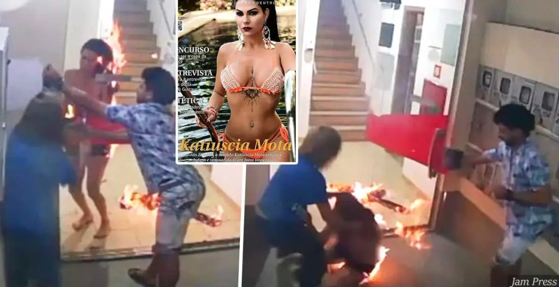 Brazilian model accidentally sets herself on fire leaving herself with 40% burns