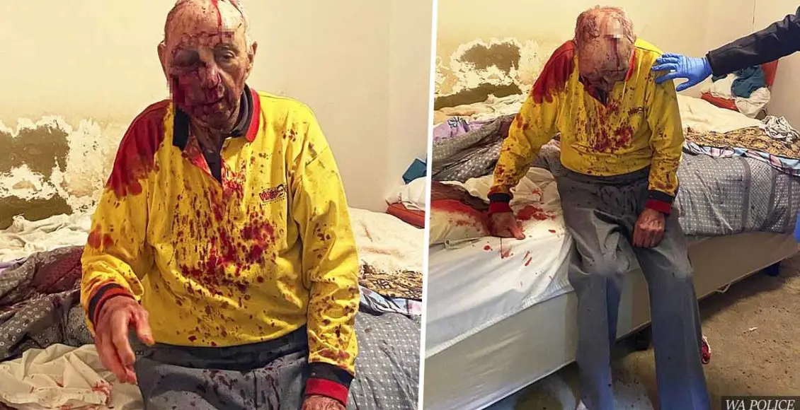 Man, 84, in critical condition after being ruthlessly attacked outside his home