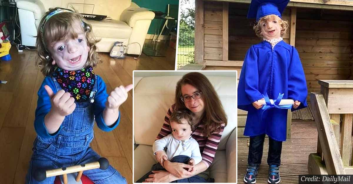 4-year-old boy with rare genetic condition is told he can't return to school