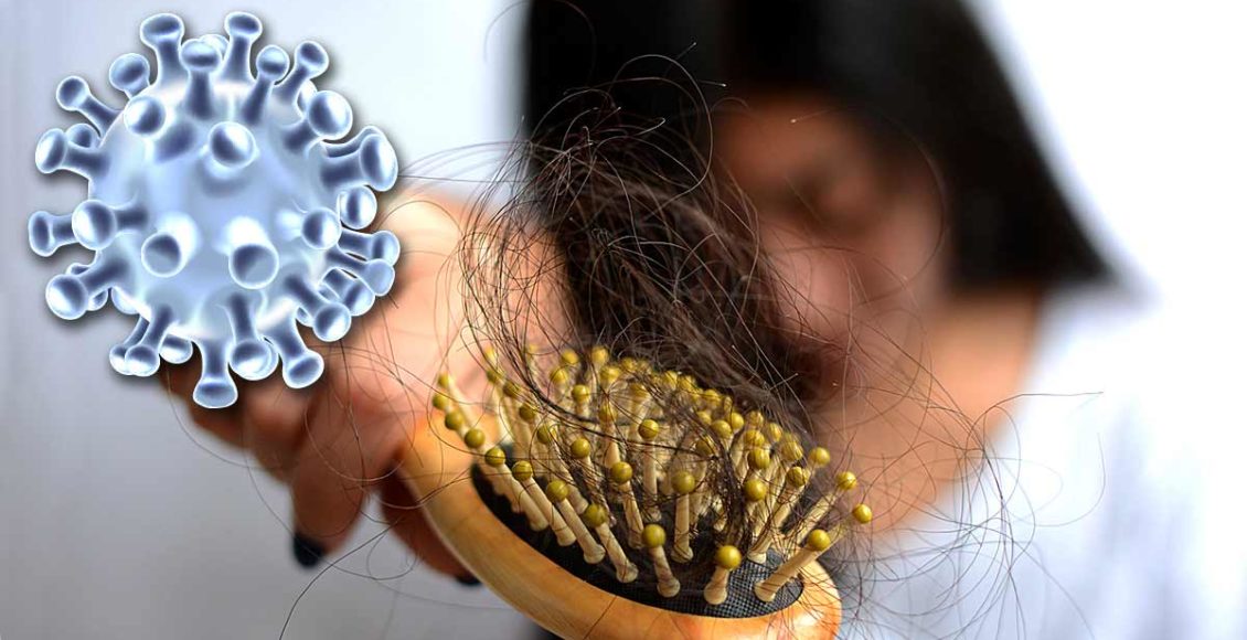 The psychological stress triggered by the pandemic is causing hair loss