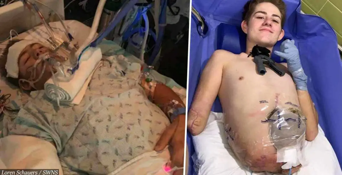 Teen Chooses To Have Half His Body Amputated So He Can Live