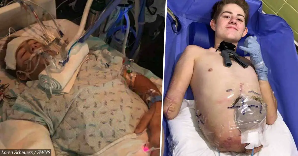 Teen Chooses To Have Half His Body Amputated So He Can Live