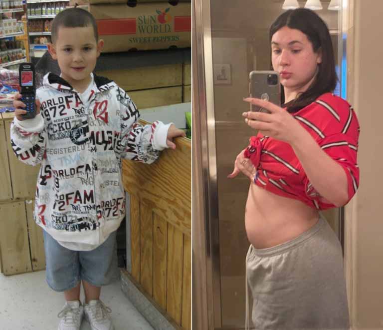 Transgender Teen Born And Raised As A Boy Is Now Preg