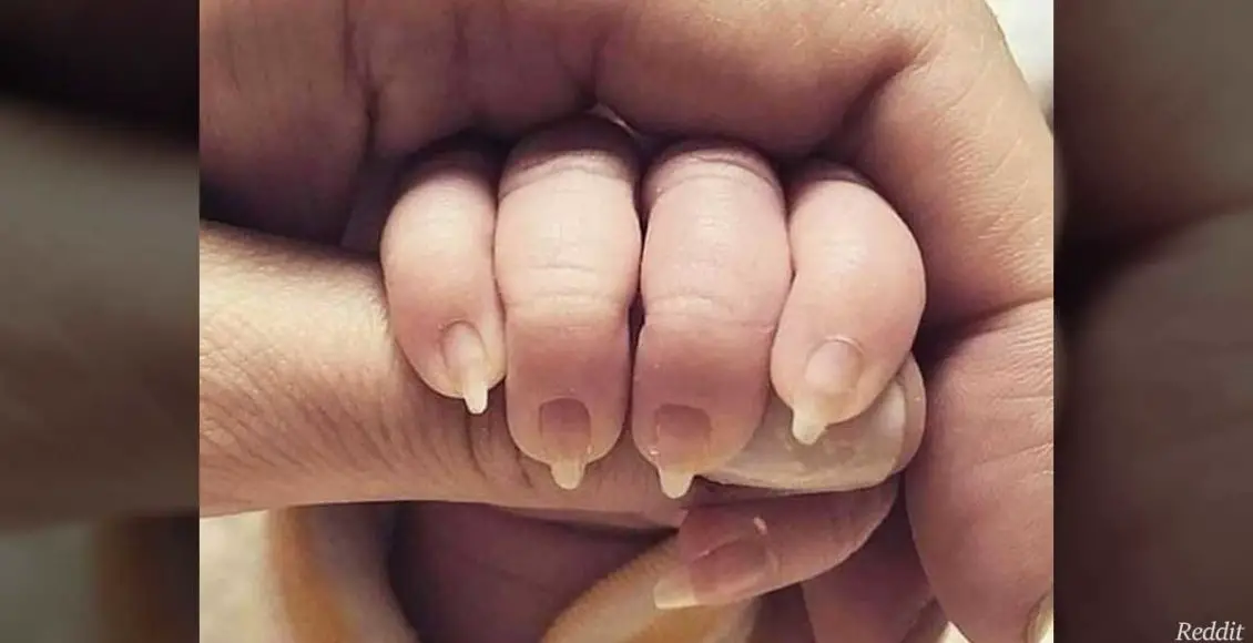Mother accused of 'child abuse' after sharing photo of her baby's creepy fingernails