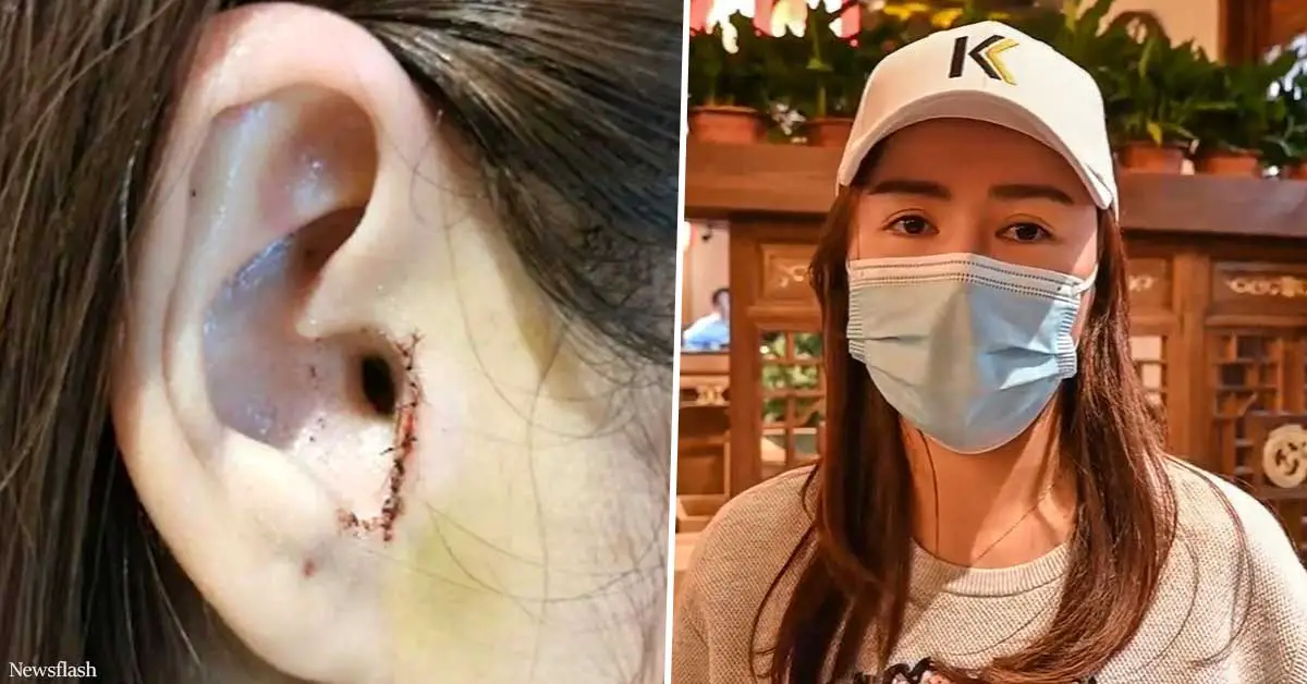 Woman outraged after doctors removed part of her ear during nose job operation