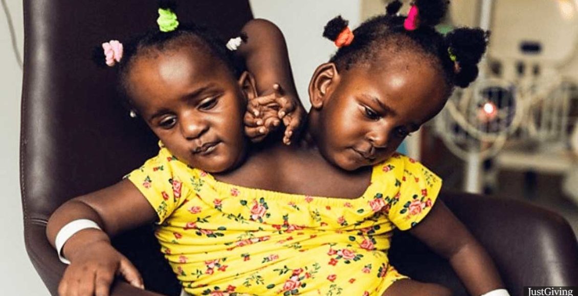 Doctors said they'd die within days after birth, but conjoined twins are now making friends at school 4 years later