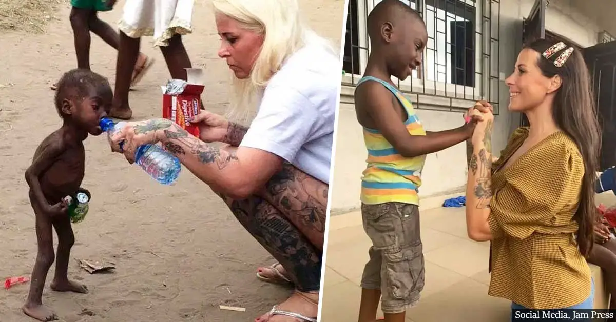 Emaciated Toddler In Viral Photo Has Transformed Into A Strong, Healthy Boy