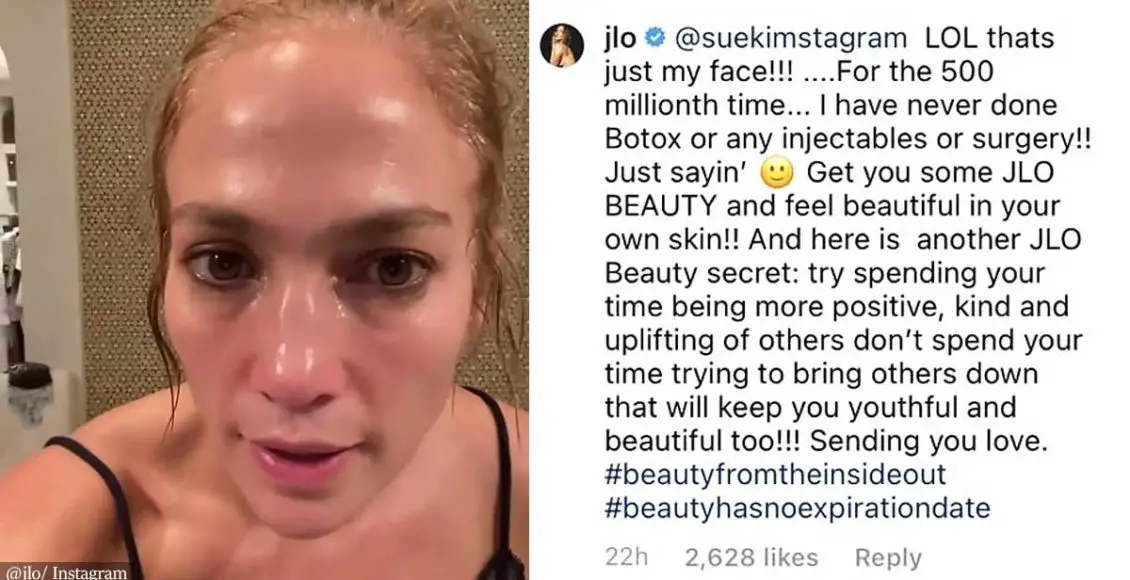 Jennifer Lopez claps back at troll accusing her of having 'tons of Botox': 'Try spending your time being more positive'