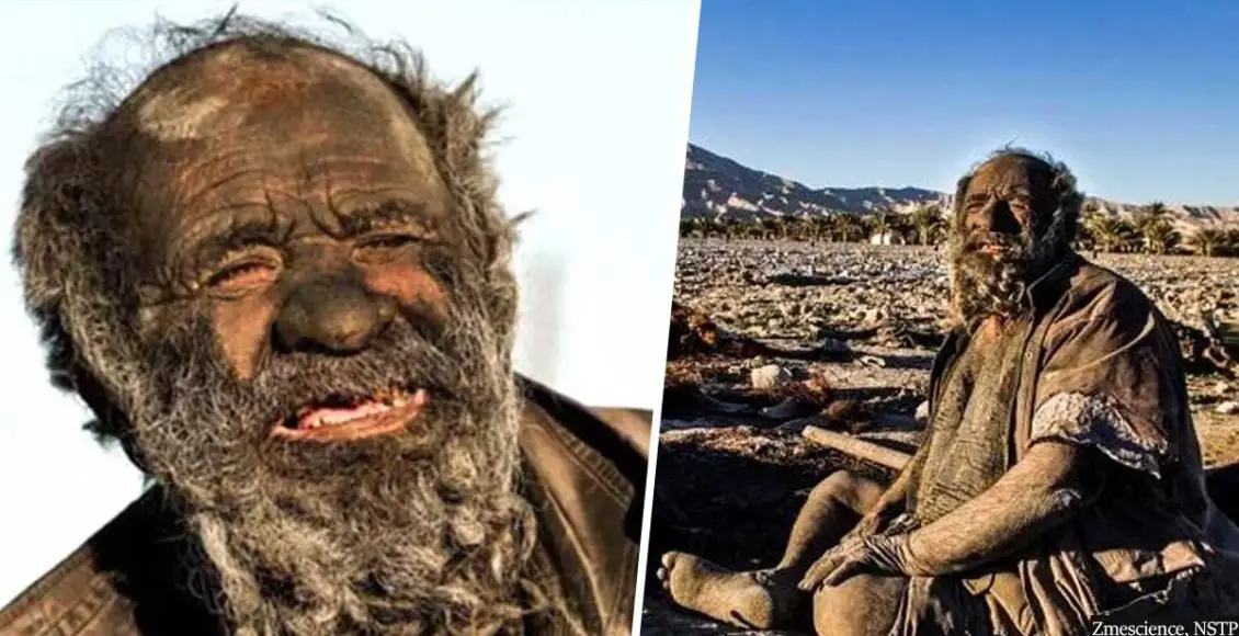 Meet The World's Dirtiest Man: He Hasn't Bathed In 67 Years