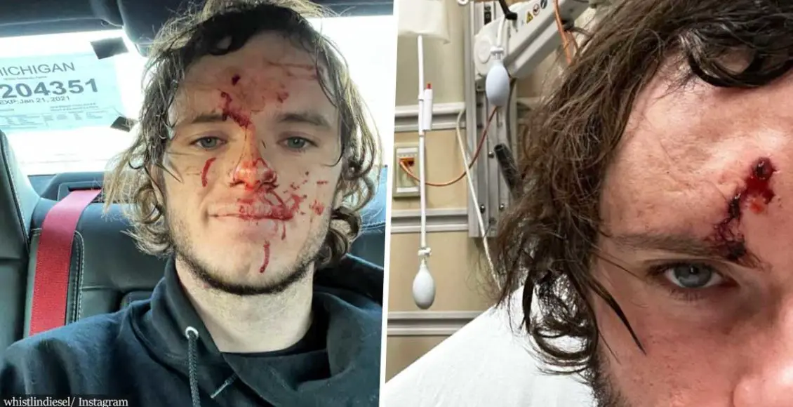 Popular YouTuber Shoots Himself in the Head in Freak Accident