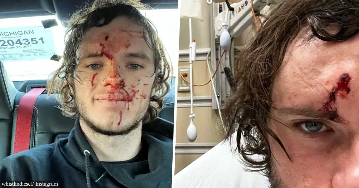 Popular YouTuber Shoots Himself in the Head in Freak Accident