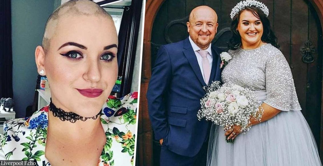 UK bride fakes cancer and shaves her head to raise donations for her dream wedding
