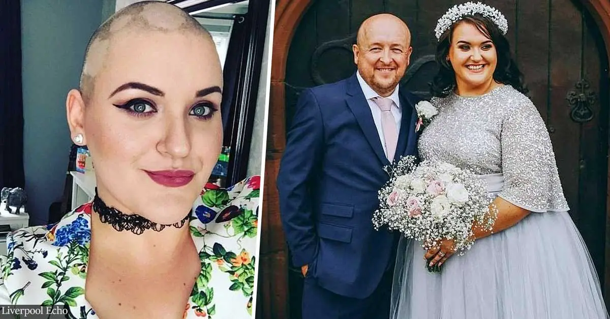UK bride fakes cancer and shaves her head to raise donations for her dream wedding