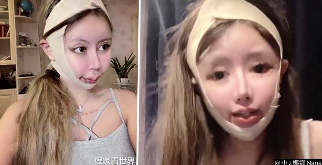 Girl, 16, allegedly undergoes 100 plastic surgeries in only 3 years