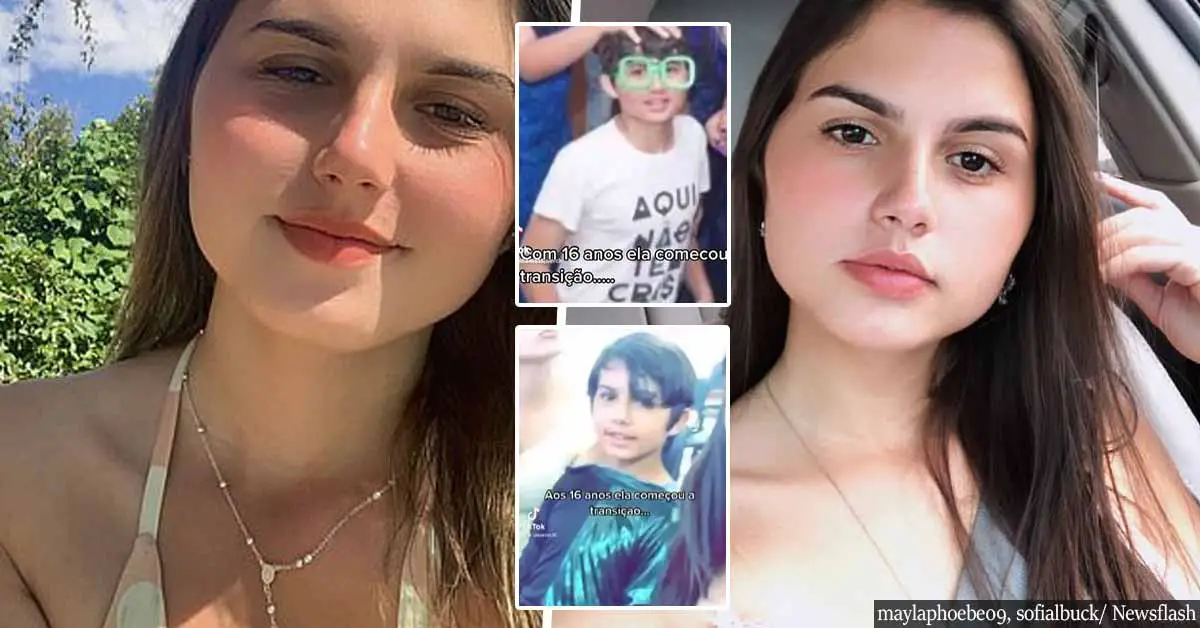 Identical twins, 19, undergo sex change surgery together in Brazil