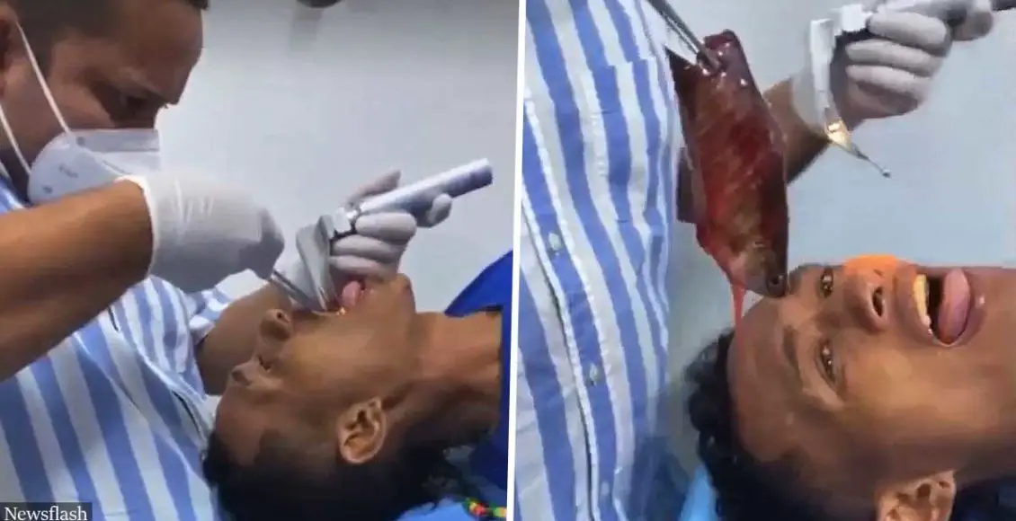 Man Gets 7-Inch-Long Fish Stuck in His Throat in Strange Fishing Accident