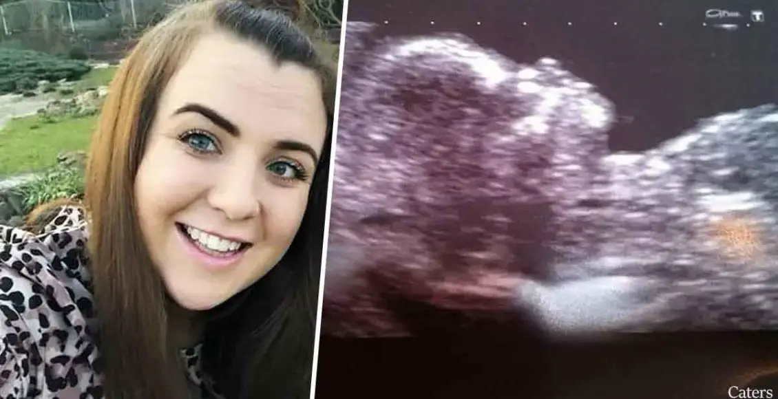 Woman Shocked To Discover She's Pregnant Despite Still Being A Virgin