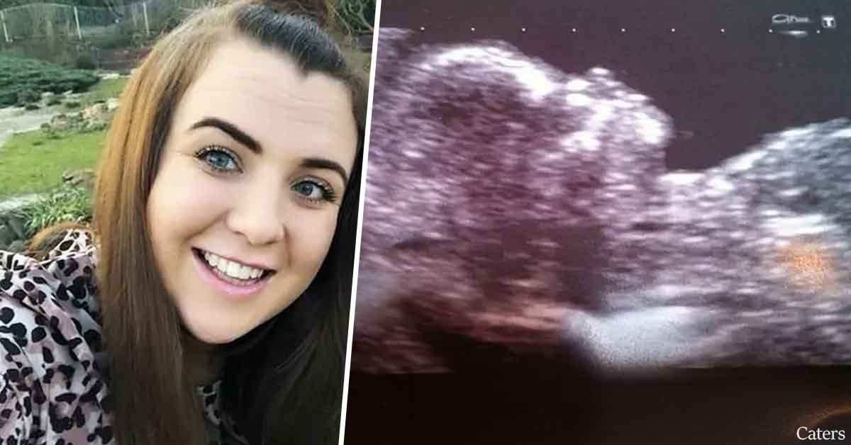 Woman Shocked To Discover She's Pregnant Despite Still Being A Virgin