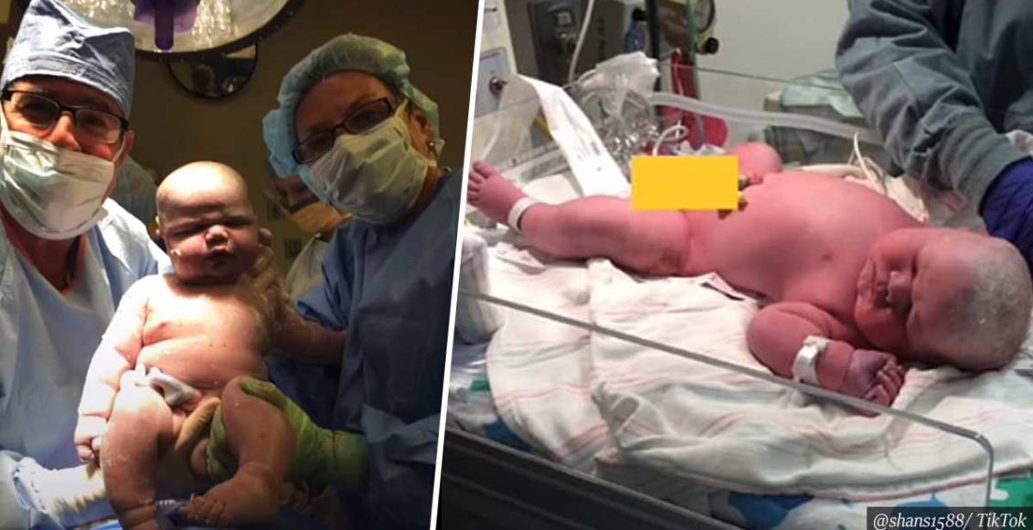 Mom Who Gave Birth To 14-Pound Baby (6.5kg) Shares Photos Of Giant Newborn Son
