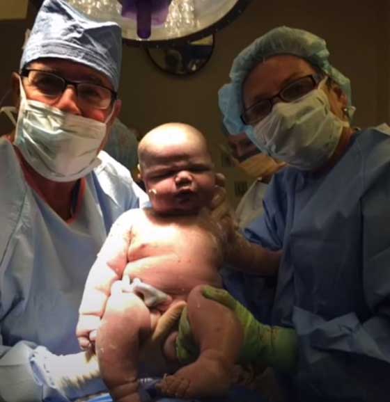 Mom Who Gave Birth To Pound Baby Kg Shares Photos Of Giant Newborn Son