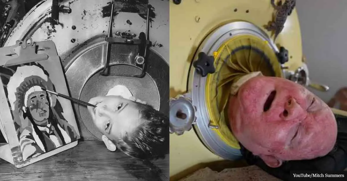 Meet the man trapped in a machine keeping him alive for over 65 years