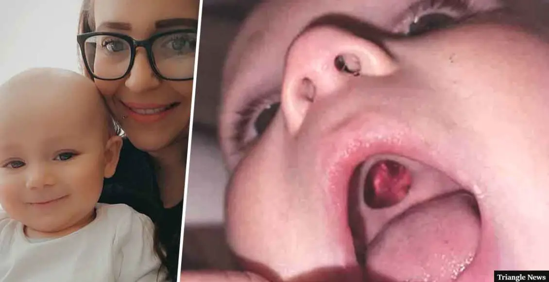 Mum rushes baby to hospital thinking he has a hole in his mouth only to realize she needs glasses