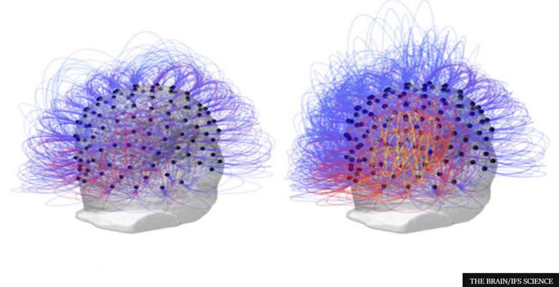 Scientists Have Resurrected A Man's Consciousness After He Spent The Last 15 Years In A Vegetative State