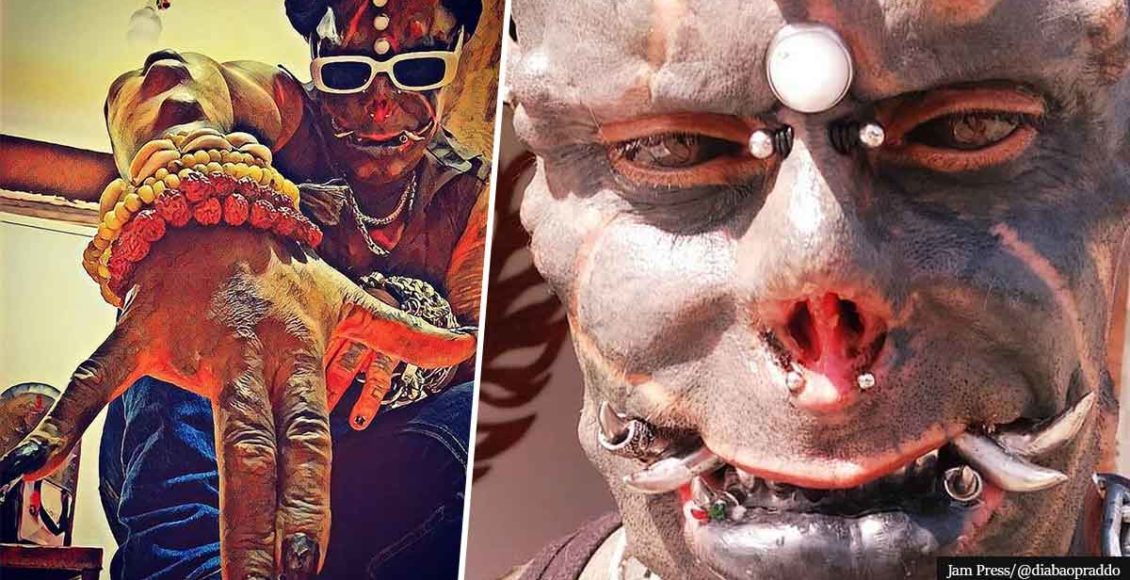 Body Modification Addict Cuts Off Fingers But Gets A Pair Of Silver Tusks