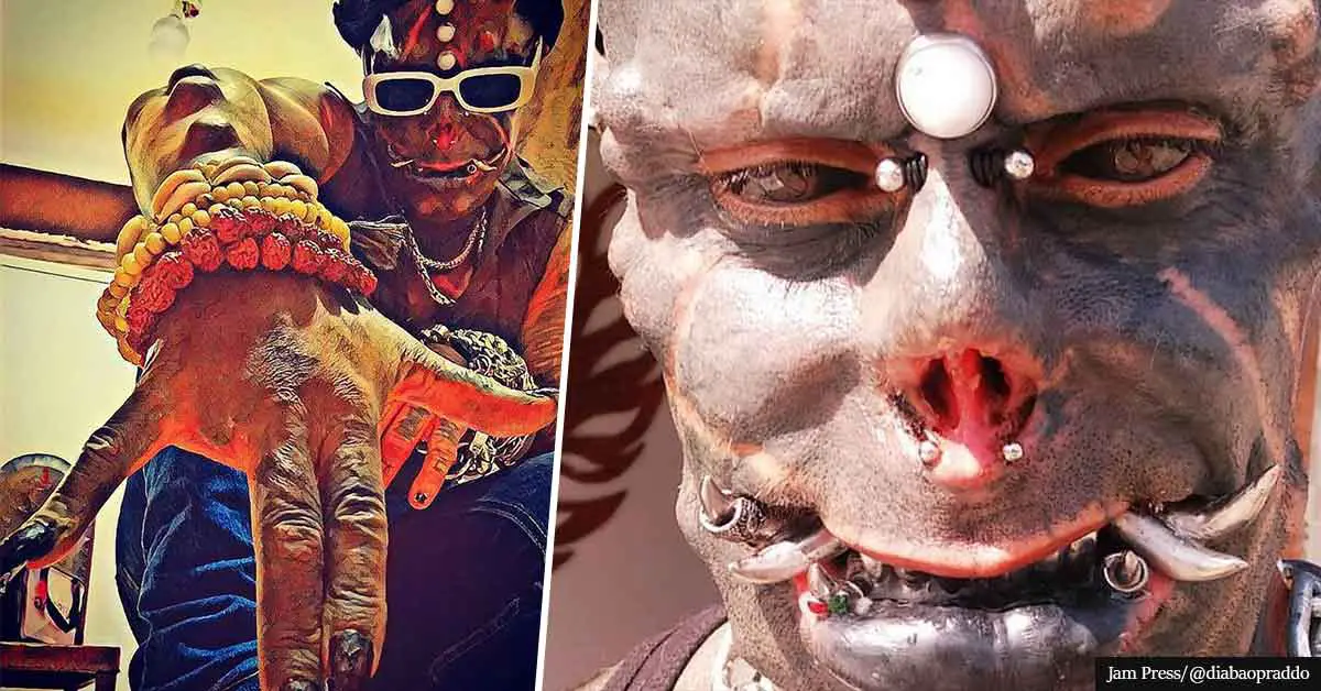 Body Modification Addict Cuts Off Fingers But Gets A Pair Of Silver Tusks
