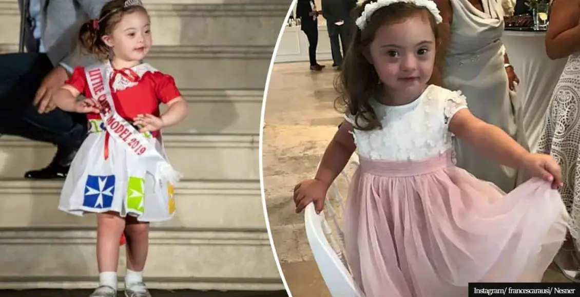 Little Princess With Down Syndrome Takes The World Of Fashion By Storm